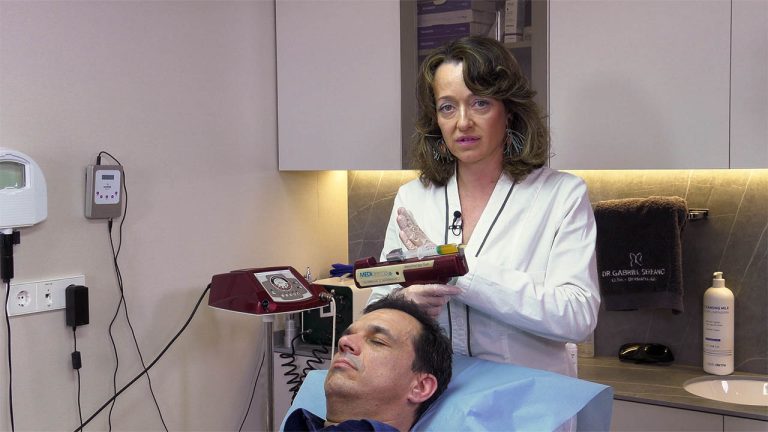 علاج الثعلبة – PRP